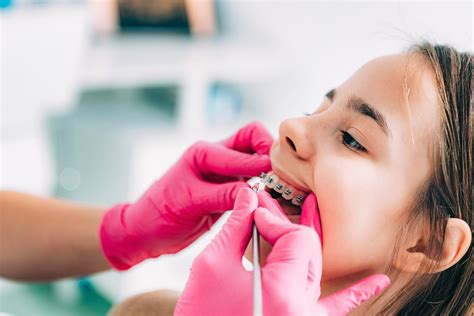 braces price philippines|4 Things You Need to Know Before Getting Braces in the .